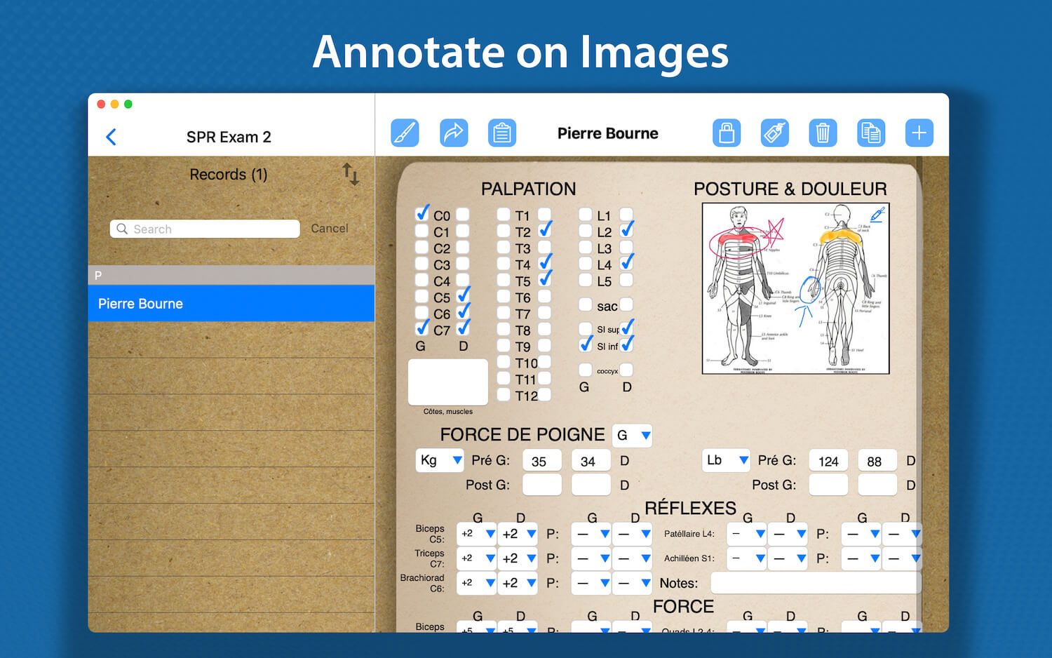 Annotate on Images